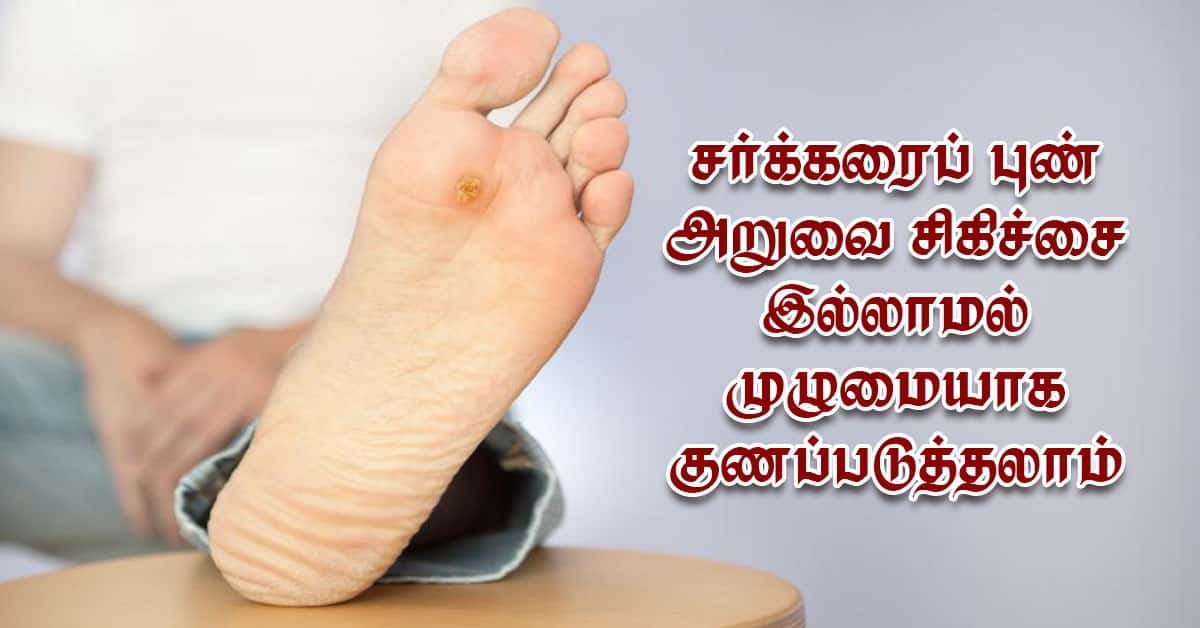 சர்க்கரைப் புண்: அறுவை சிகிச்சை இல்லாமல் முழுமையாக குணப்படுத்தலாம்